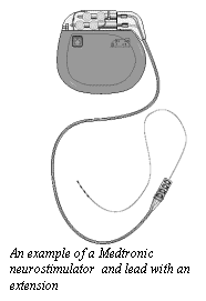 Text Box:  
An example of a Medtronic  neurostimulator  and lead with an extension
